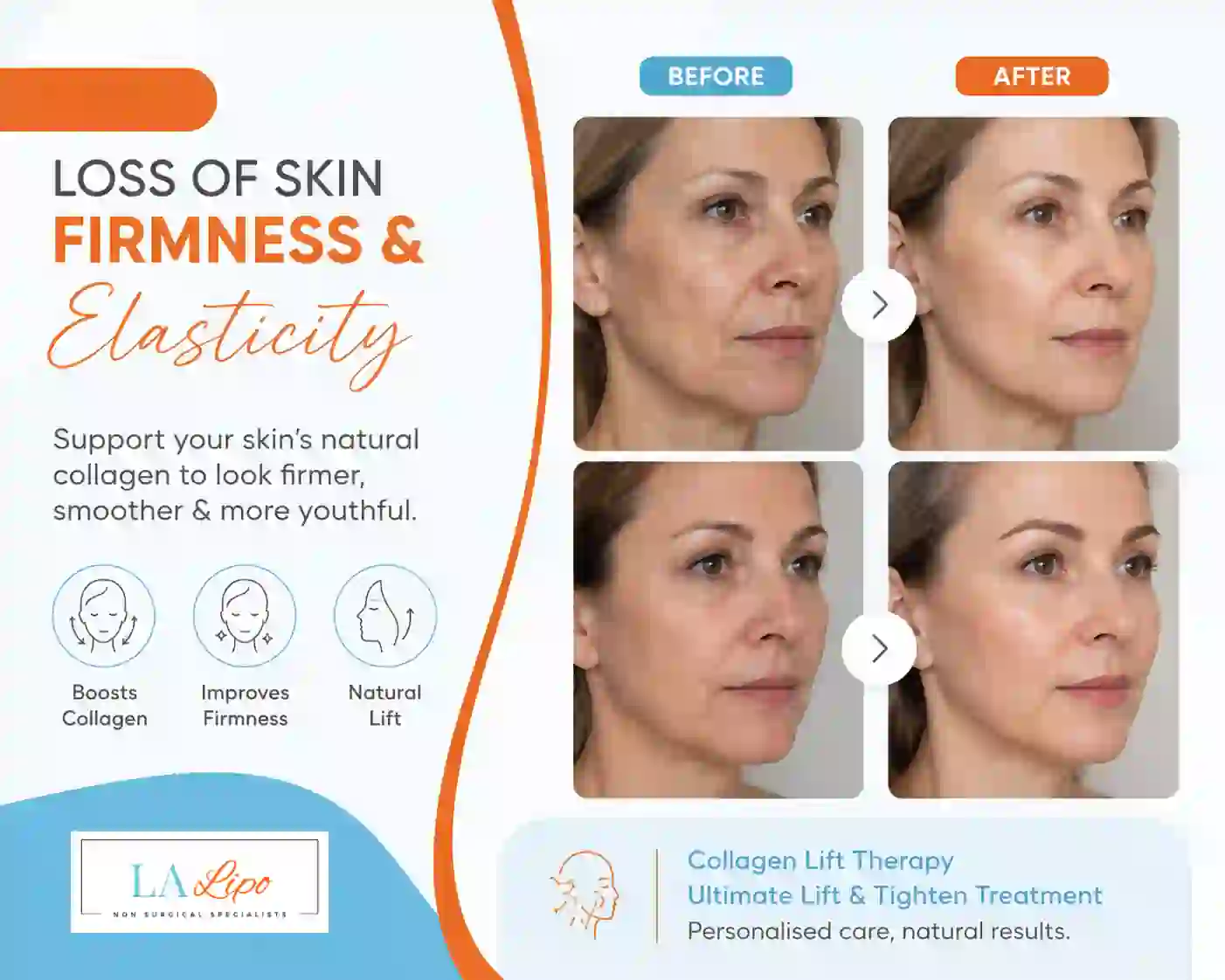 Sign #7: Loss of Skin Firmness and Elasticity Welford-on-Avon